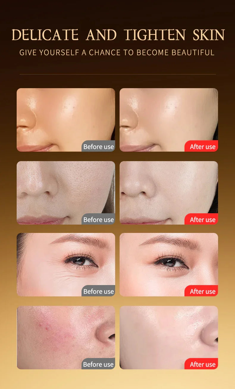 3-in-1 Facial beauty device