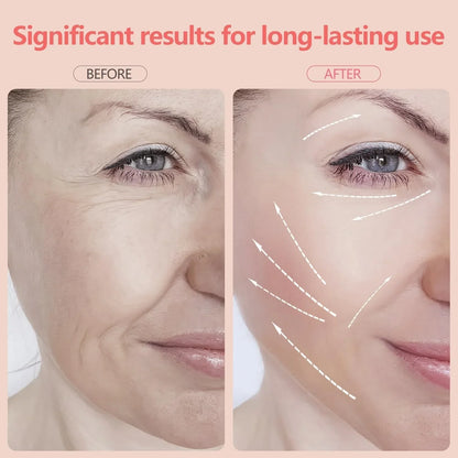 7-in-1 LED Facial Sculptor - GlintSkin