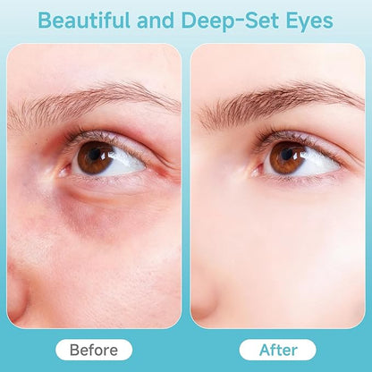 Eye hot and cold therapy device