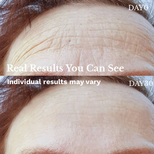 LED Light Therapy Face Mask –Classic Series