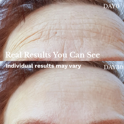 LED Light Therapy Face Mask –Classic Series