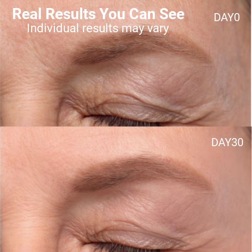 LED Light Therapy Face Mask –Classic Series