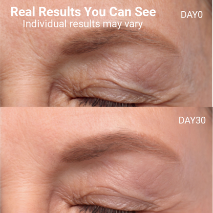 LED Light Therapy Face Mask –Classic Series