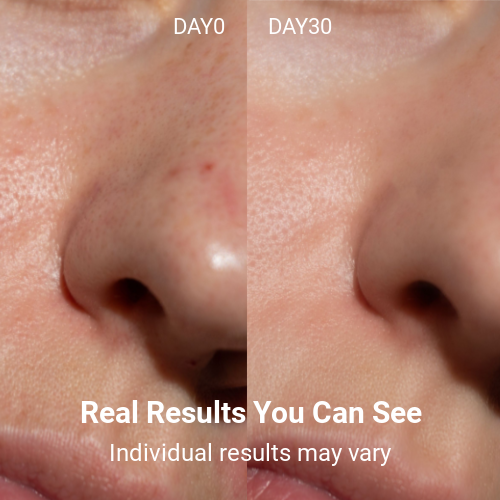 LED Light Therapy Face Mask –Classic Series