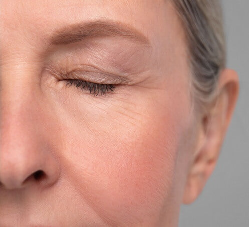 Shutterstock_eye-aft_c4306951-0dff-4b8f-a85f-b21e8b5fa40d - GlintSkin