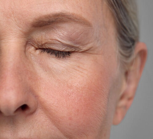 Shutterstock_eye-bef_dbddc376-e112-484d-afd3-8b4012440bd8 - GlintSkin
