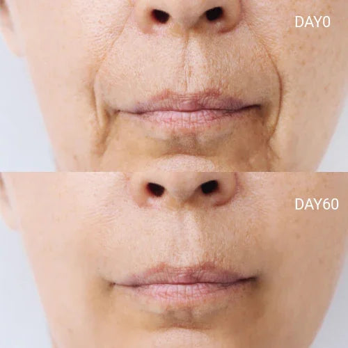 Best Red Light Mask | LED Face Mask for Anti-Aging & Skin Rejuvenation - GlintSkin
