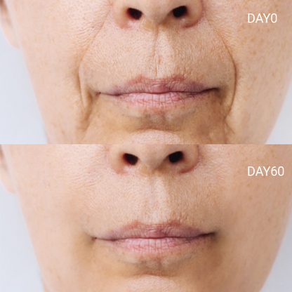 LED Light Therapy Face Mask –Classic Series