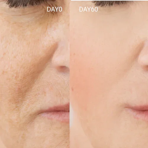 Best Red Light Mask | LED Face Mask for Anti-Aging & Skin Rejuvenation - GlintSkin