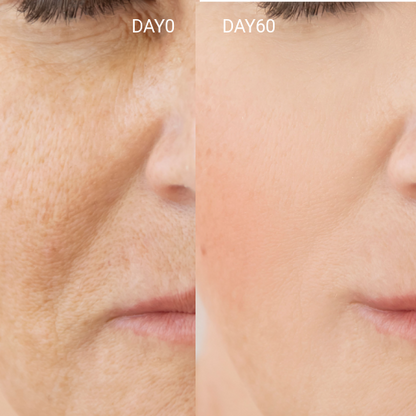 LED Light Therapy Face Mask –Classic Series